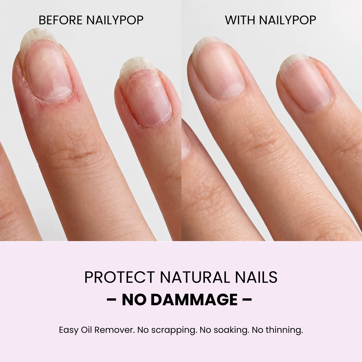 Nailypop refill pack - UV-free gel strips
